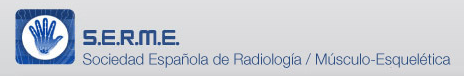 Sociedad Española de Radiología Músculo-Esquelética Sociedad Española de Radiología Músculo-Esquelética